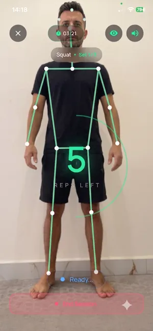 Smart Camera